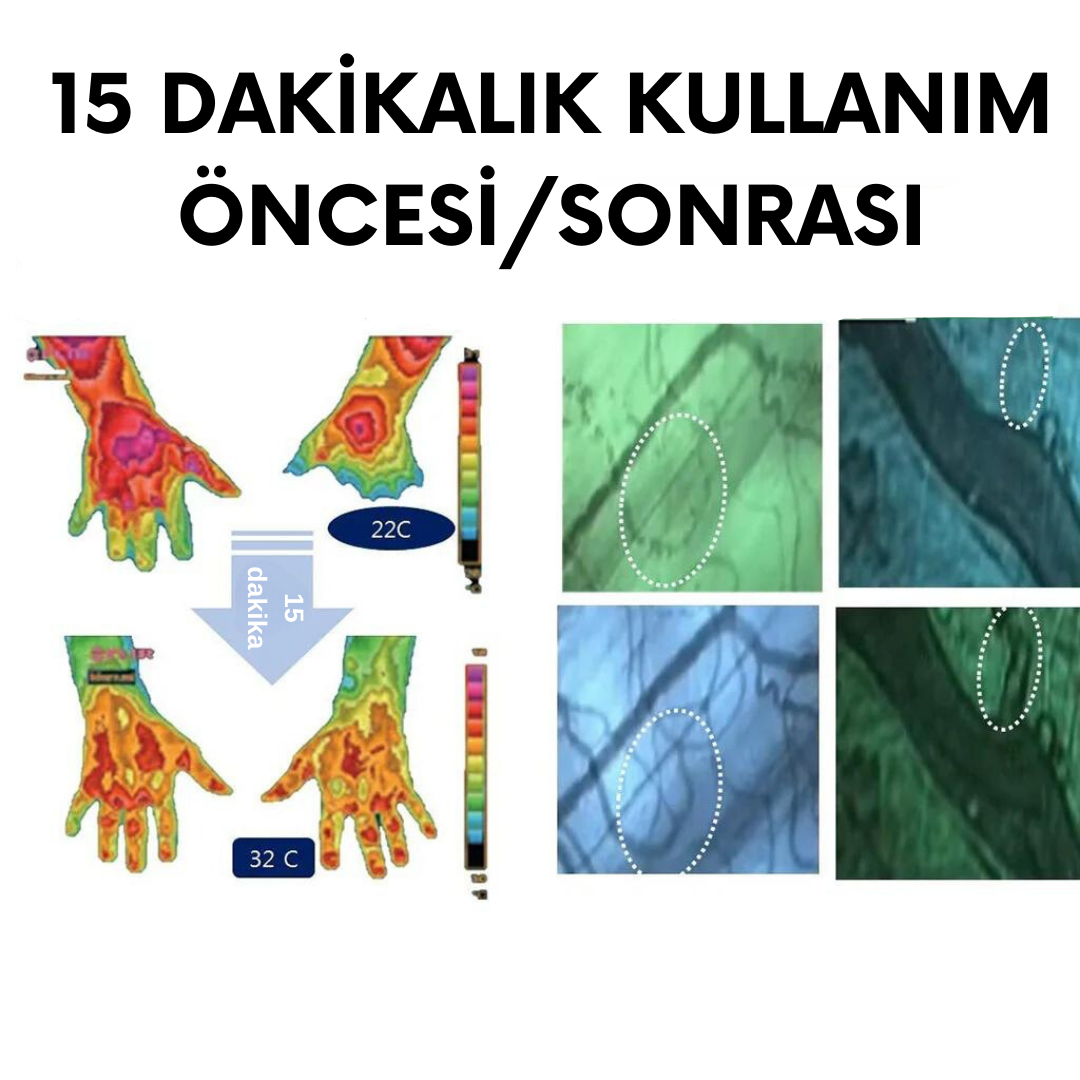 Topraklanma Matı